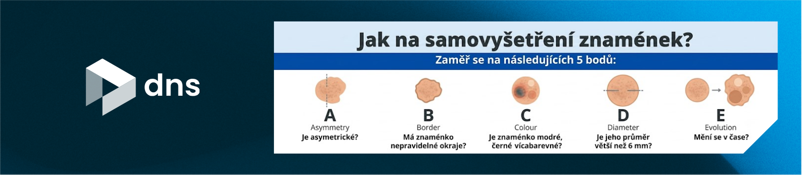 Kontrola pigmentových znamének